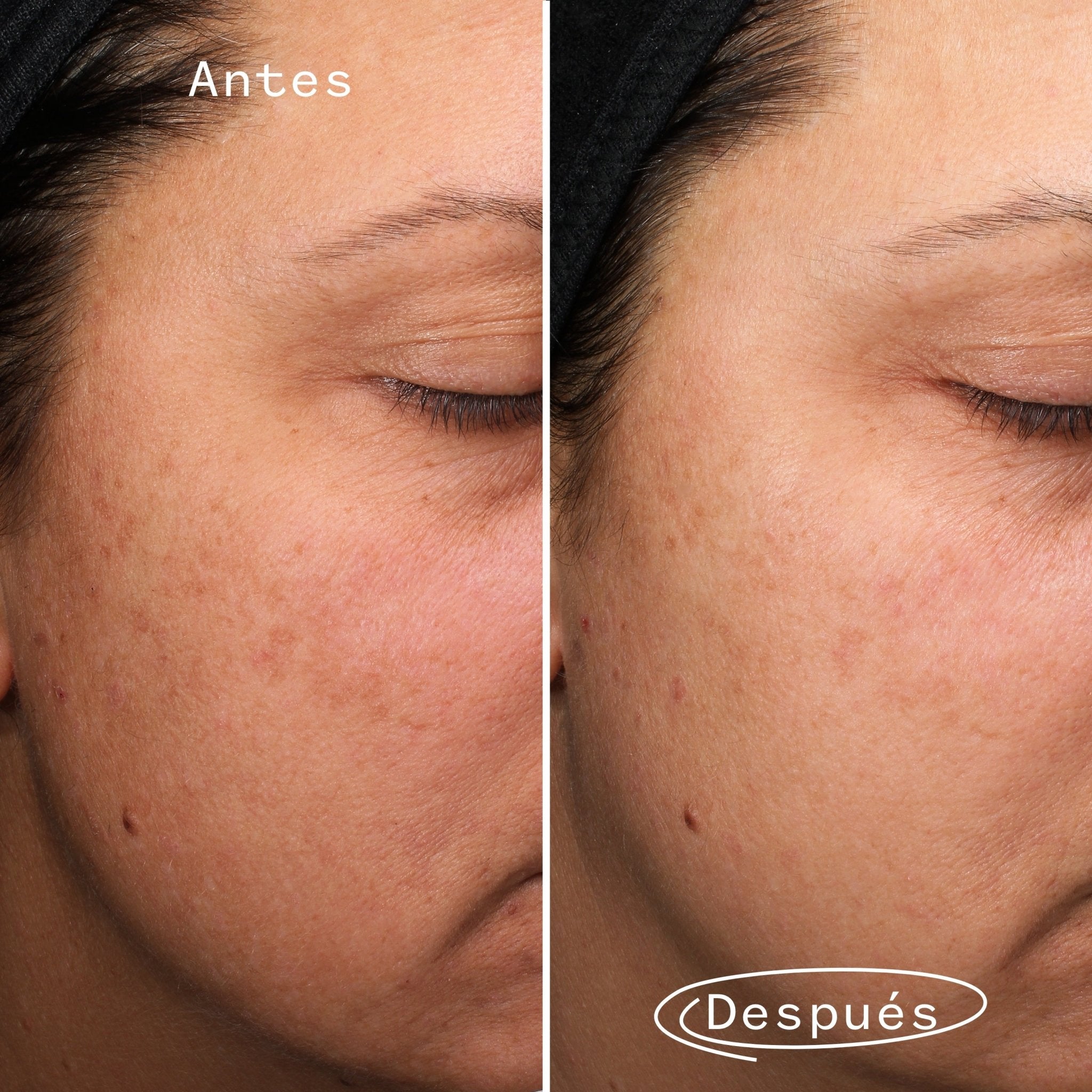 Fade Forward - LACONICUM