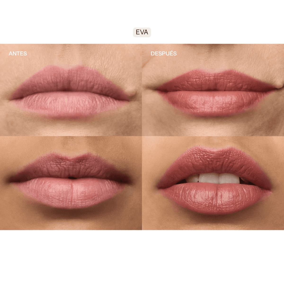 Multiactive Advanced Lip Serum - LACONICUM