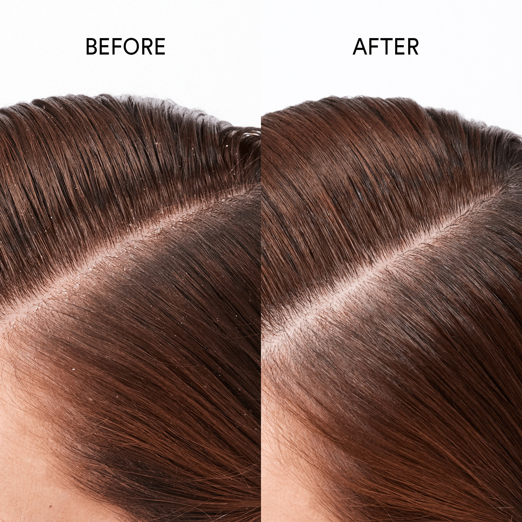 Pure Genius Scalp Oil - LACONICUM