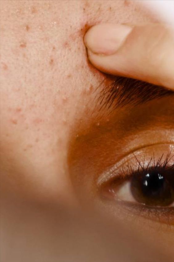 Todo lo que tienes que saber de la niacinamida y cómo incluirla en tu rutina - LACONICUM