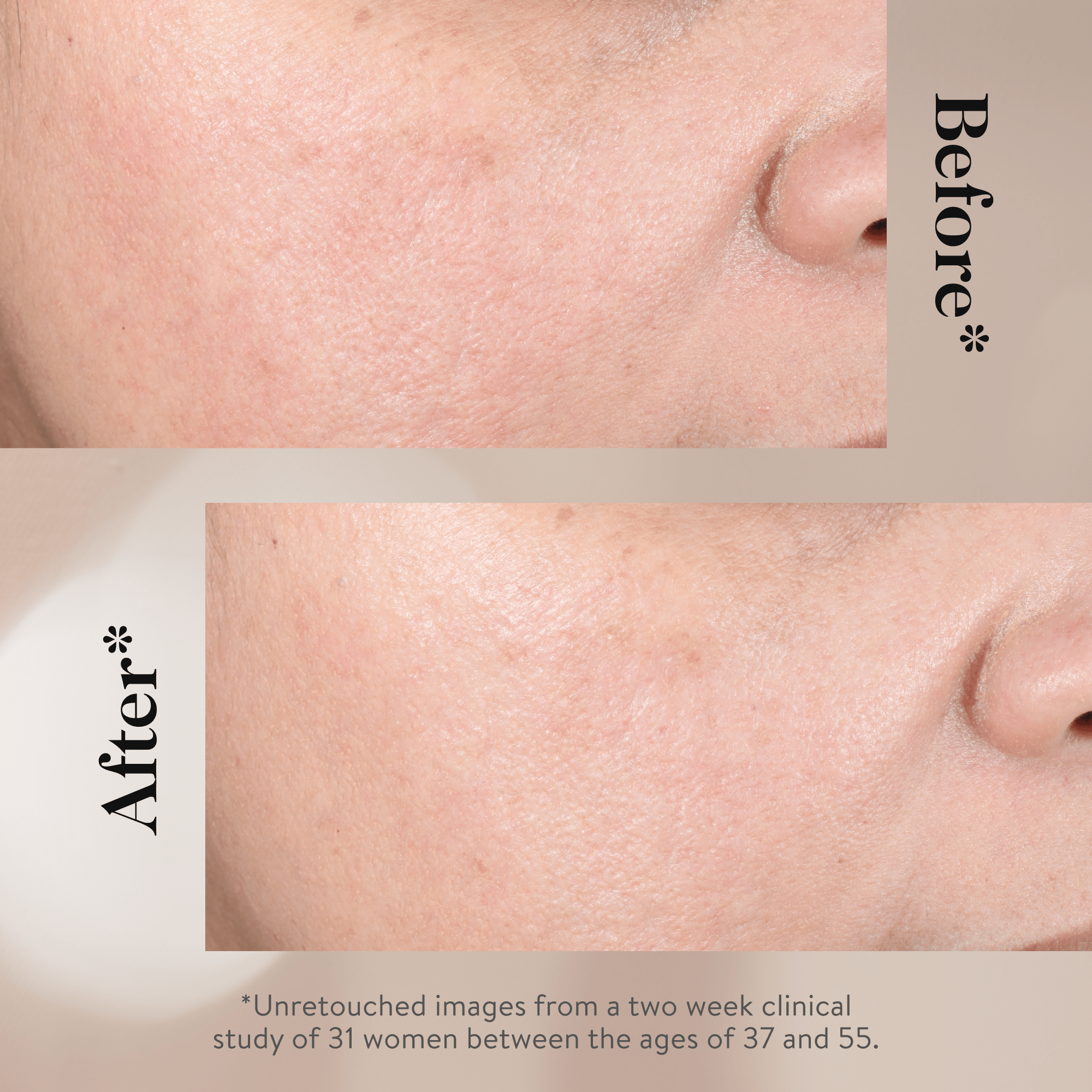 15% Glycolic Acid Overnight Glow Peel - LACONICUM